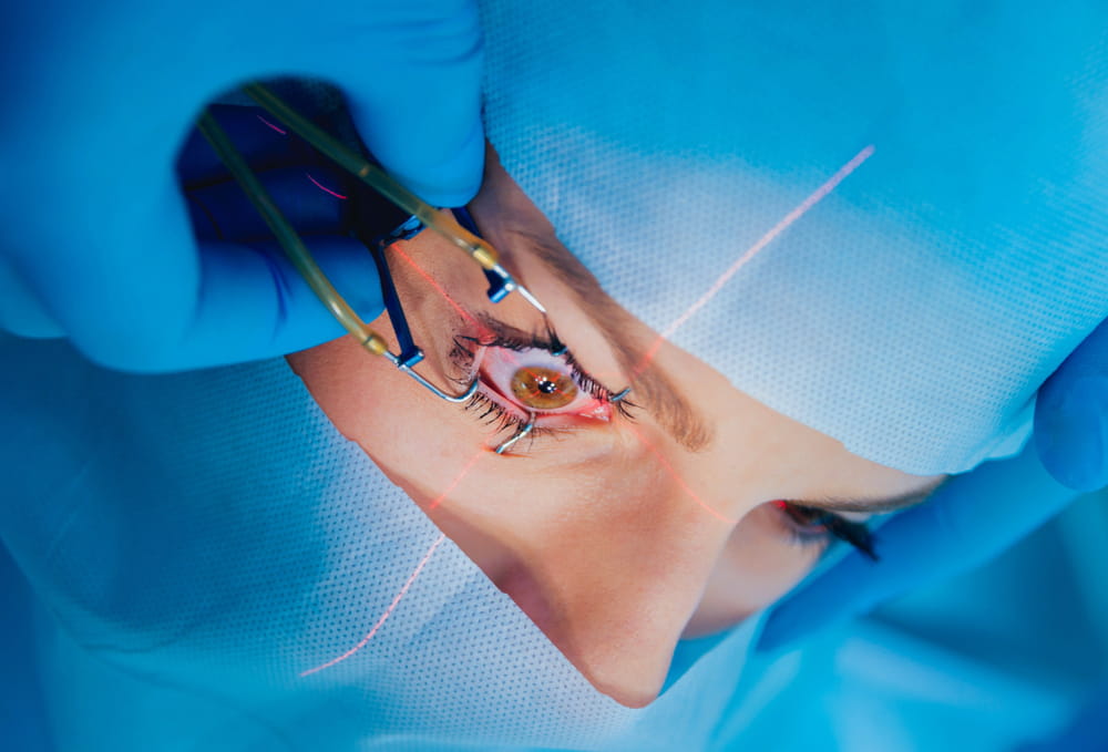 Lasik-Pre-Operative-Procedure
